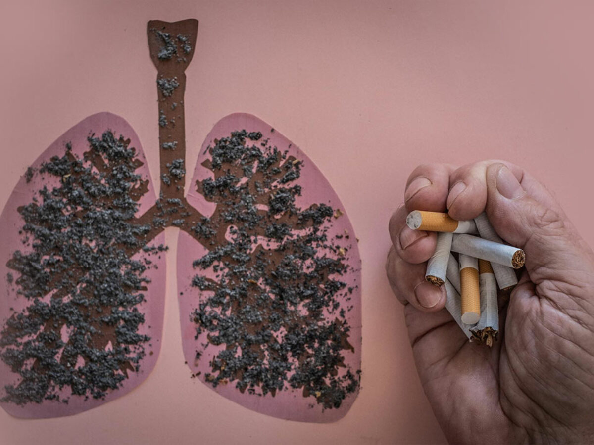 Non Smokers Lung Cancer: जरुरी नहीं कि सिगरेट पीने से कैंसर हो, इन कारणों से भी होता है कैंसर