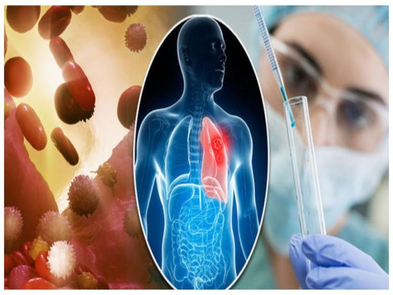 Cancer Treatment: मात्र 100 रुपए में होगा कैंसर का इलाज! जानें वैज्ञानिकों ने क्या कहा