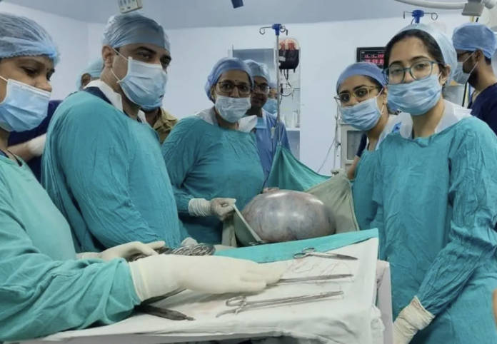 16 kg tumor removed in Bhopal